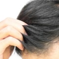 Can hair grow back after loss