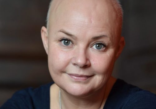 Will hair loss grow back due to diet?